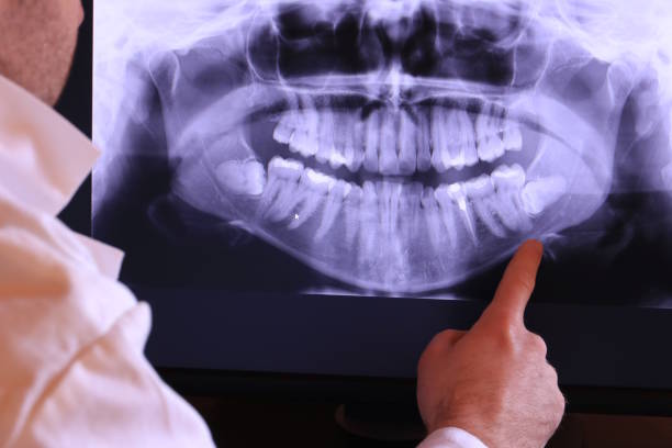 Best Emergency Treatment for Dental Infections or Abscesses in Honokaa, HI